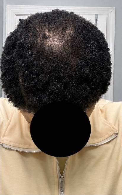 12-Month Result